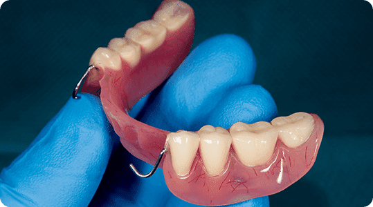 Removable Partial Dentures Custom Denture Clinic