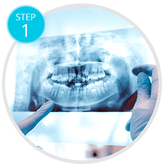 First Visit & Consultation Dentures